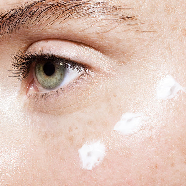 How To Get Rid of Dark Circles Under Your Eyes